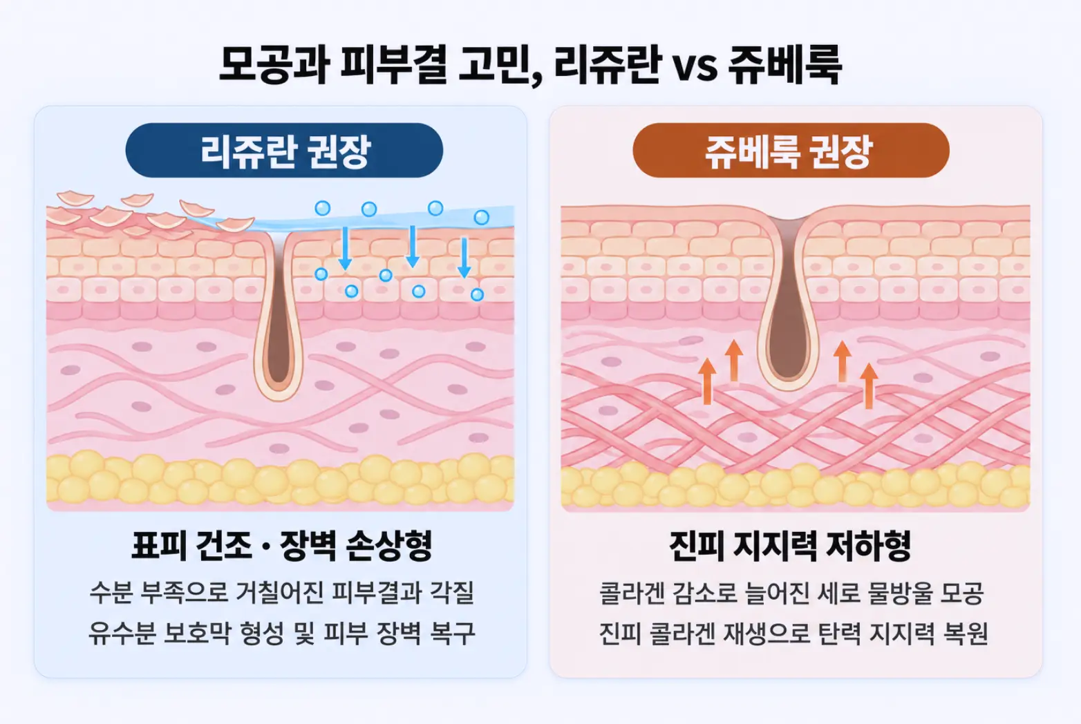수분 부족으로 거칠어진 표피 장벽형 피부결에 권장되는 리쥬란과 진피 탄력 저하로 늘어진 세로 물방울 모공에 권장되는 쥬베룩 비교 모식도