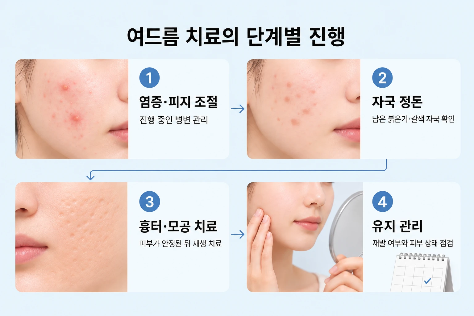 염증·피지 조절부터 자국 정돈과 흉터·모공 치료, 유지 관리로 이어지는 단계