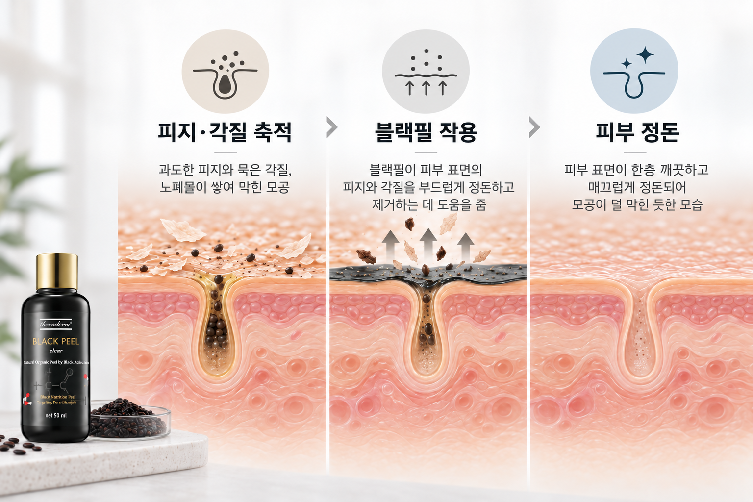 블랙필로 피지와 각질을 정돈하는 과정