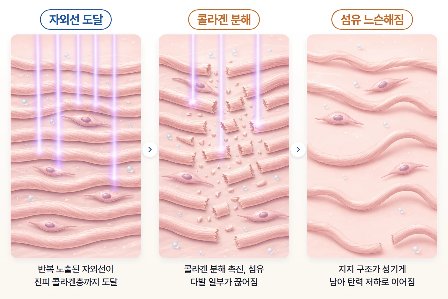 자외선이 진피에 닿아 콜라겐 섬유가 끊어지고 느슨해지는 변화를 단계별로 나타낸 작용 원리 일러스트
