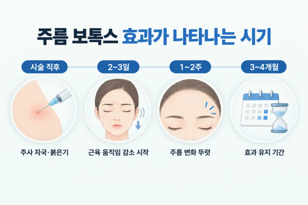 주름 보톡스 효과 유지 기간