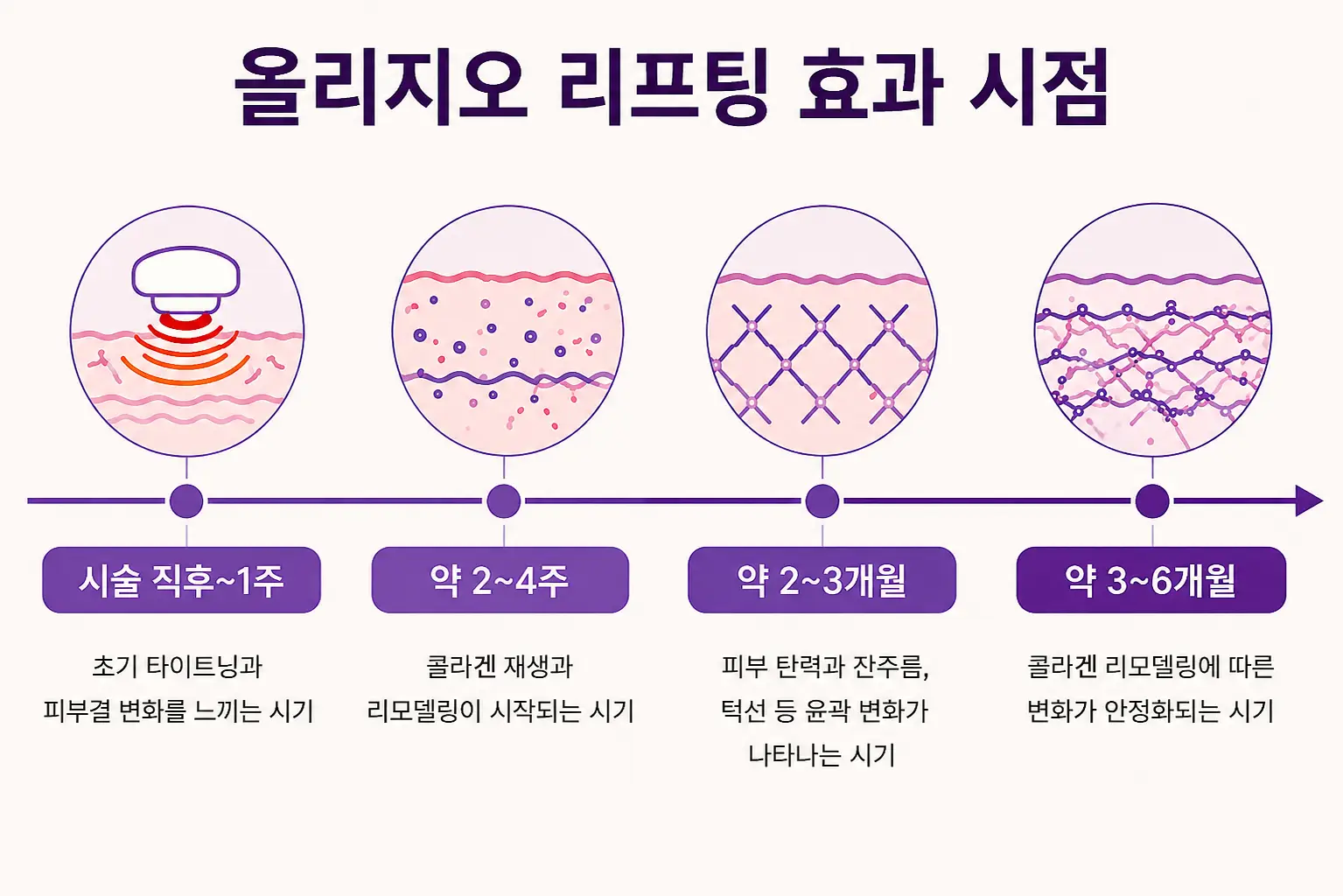 올리지오 리프팅 효과가 나타나는 시점과 피부 변화 과정