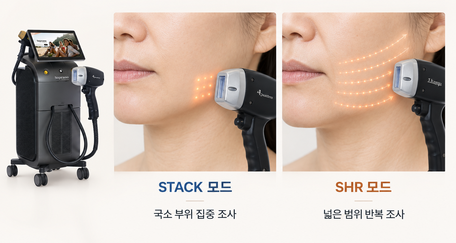티타늄 리프팅 STACK 모드 국소 조사와 SHR 모드 넓은 범위 반복 조사