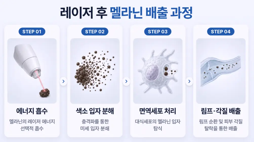 레이저 에너지 흡수부터 색소 입자 분해, 대식세포 탐식, 림프 순환 및 각질 탈락을 통한 멜라닌 배출 4단계 과정