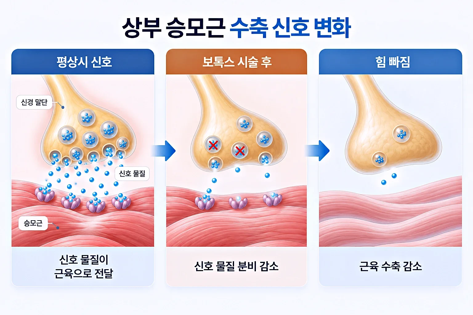 신경 말단의 신호 물질 방출과 근섬유 수축 신호 감소 단계를 순서대로 담은 개념도