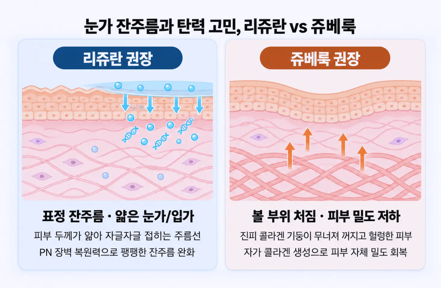 피부가 얇아 자글자글 접히는 눈가 잔주름 완화를 돕는 리쥬란과 볼 부위 처짐 및 피부 밀도 저하를 개선하는 쥬베룩의 주 타깃층 비교 도식