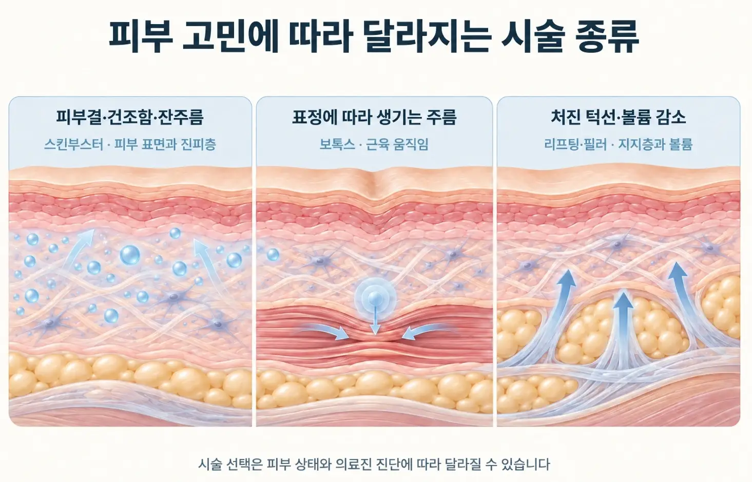 피부결과 건조함, 표정 주름, 처진 턱선과 볼륨 감소에 따른 시술 종류 비교