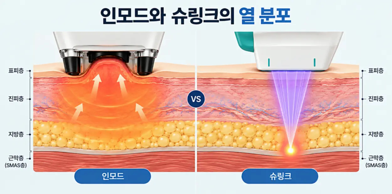 인모드 고주파와 슈링크 집속 초음파의 피부층별 열 전달 방식 및 작용 깊이 비교 이미지