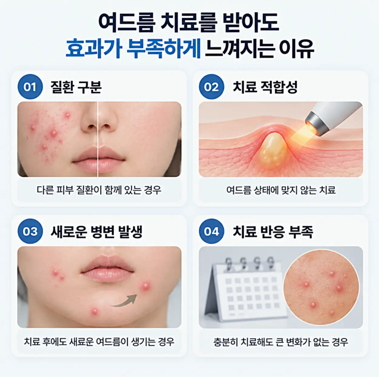 여드름 치료를 받아도 효과가 부족하게 나타나는 이유 4가지를 설명하는 이미지