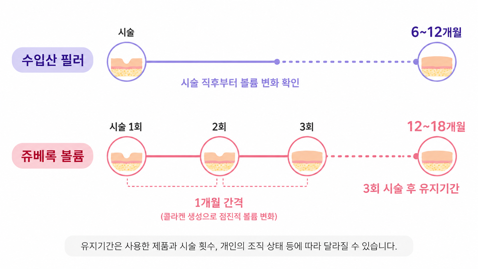 수입산 필러 6~12개월과 쥬베룩 볼륨 3회 시술 후 12~18개월 유지기간 비교