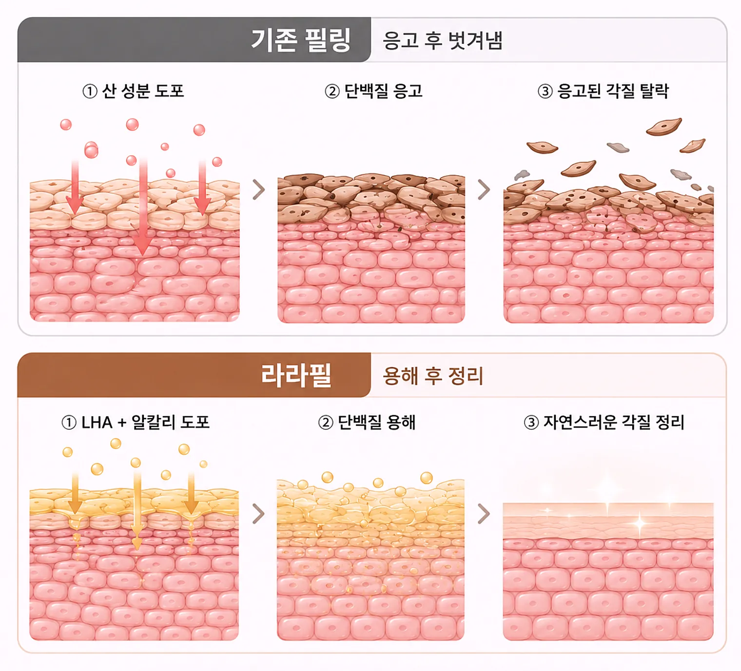 기존 필링 각질 응고 방식과 라라필 용해 방식 비교 단면도