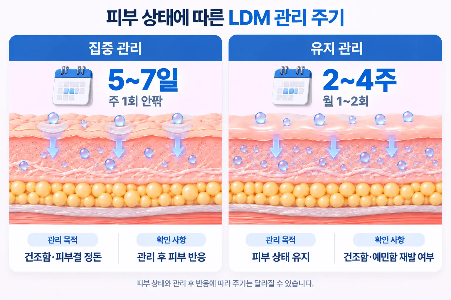 피부 상태에 따른 LDM 관리 주기 비교 이미지로, 집중 관리 5~7일 주 1회와 유지 관리 2~4주 월 1~2회의 관리 간격, 피부 수분 상태 및 피부결 관리 목적을 설명한 메디컬 일러스트