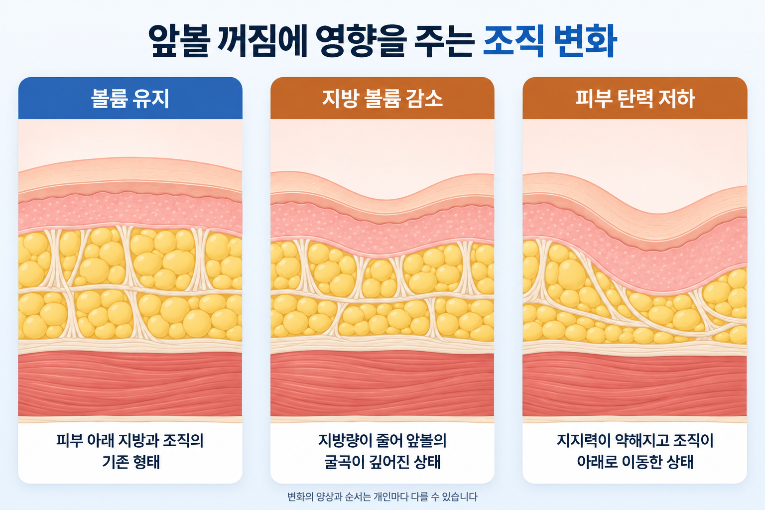 노화에 따른 앞볼 지방 볼륨 감소로 굴곡이 깊어지는 변화와 피부 탄력 저하로 조직이 아래로 이동하는 구조