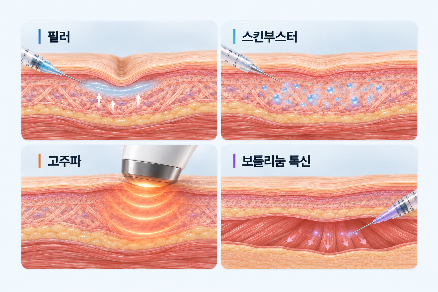 필러 스킨부스터 고주파 보툴리눔 톡신의 목 피부 단면 작용 원리