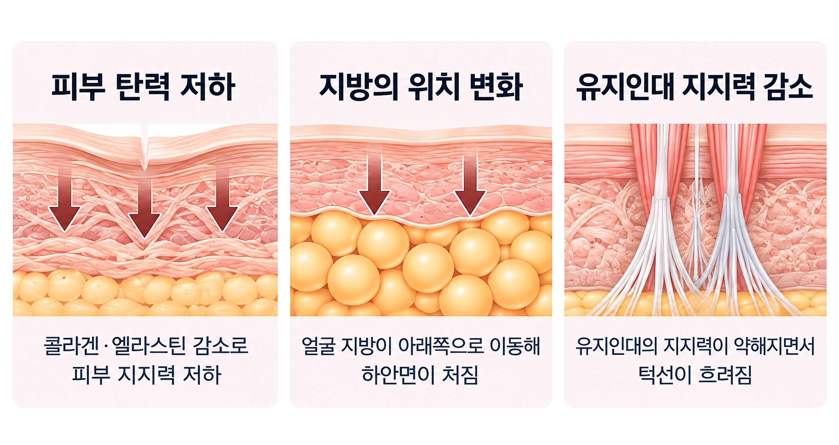 피부 탄력·지방 위치·유지인대 변화로 살펴보는 턱선 처짐 원인