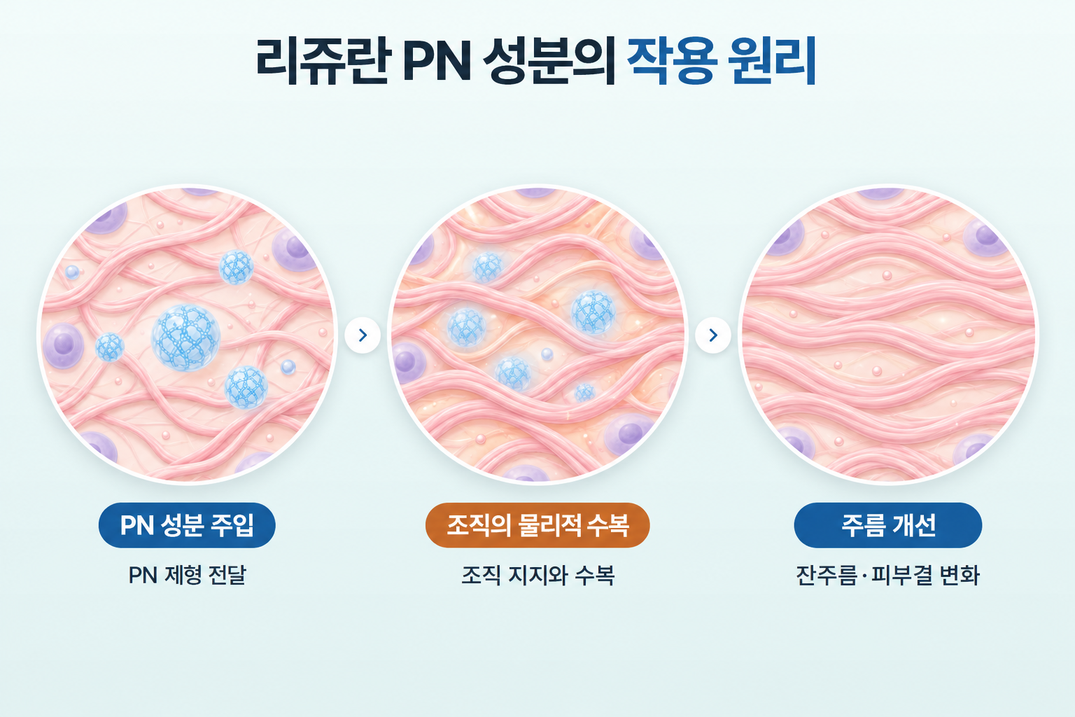 리쥬란 PN 성분 주입부터 피부 조직의 물리적 수복과 주름 개선까지의 3단계 작용 과정