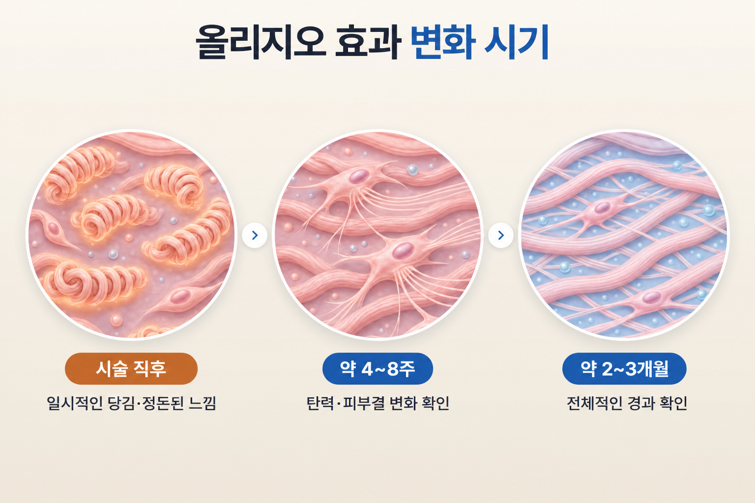 올리지오 시술 직후부터 4~8주, 2~3개월까지 효과 변화 시기