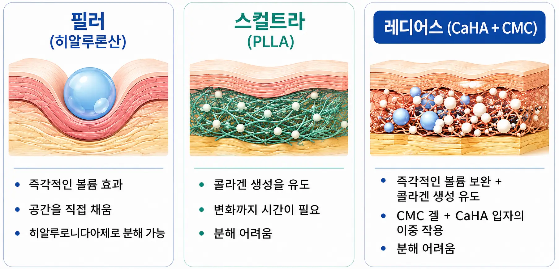 레디어스·필러·스컬트라의 효과와 분해 가능성 차이