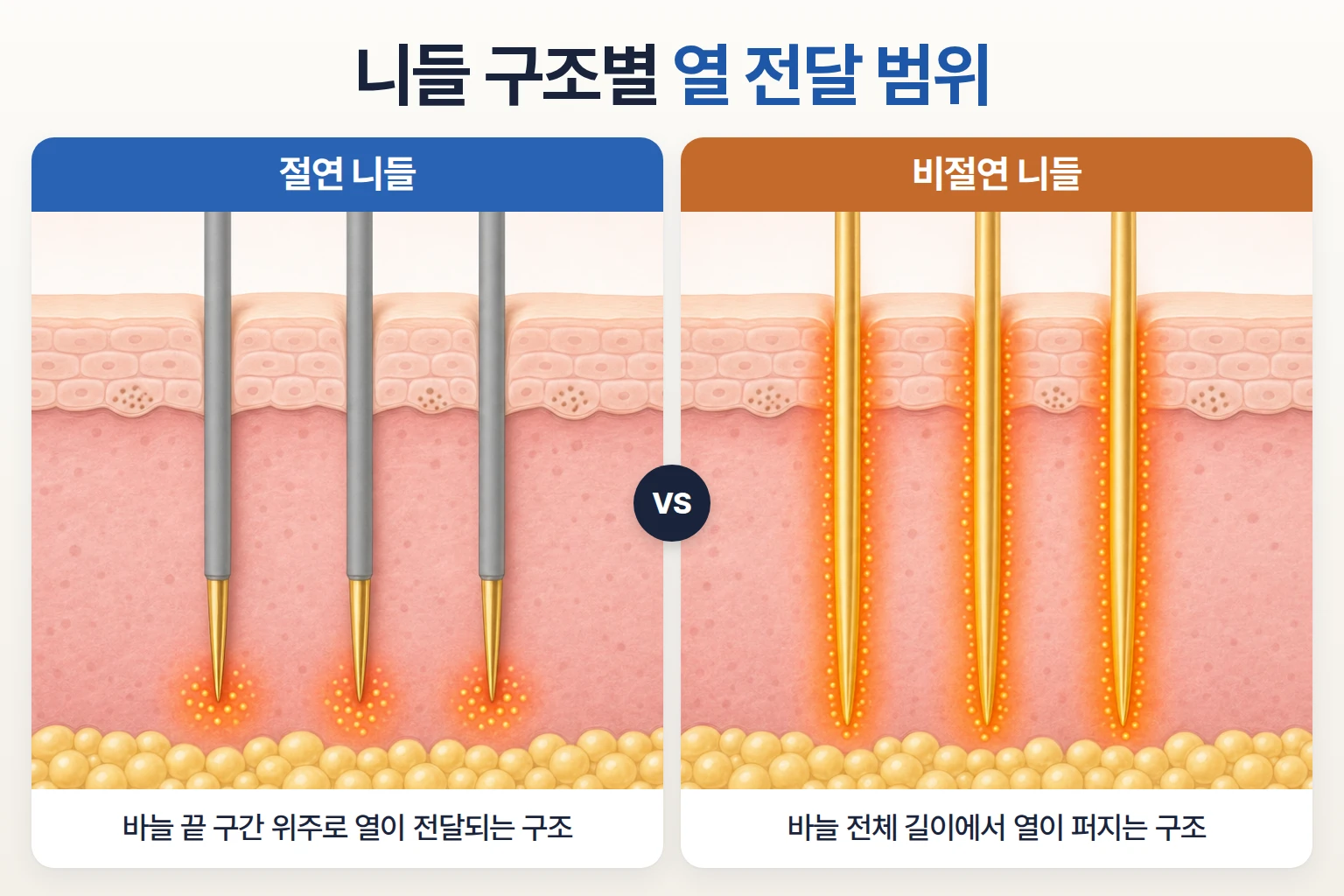 절연 니들과 비절연 니들의 열 전달 범위를 표피와 진피 단면에서 비교한 마이크로니들 구조 모식도
