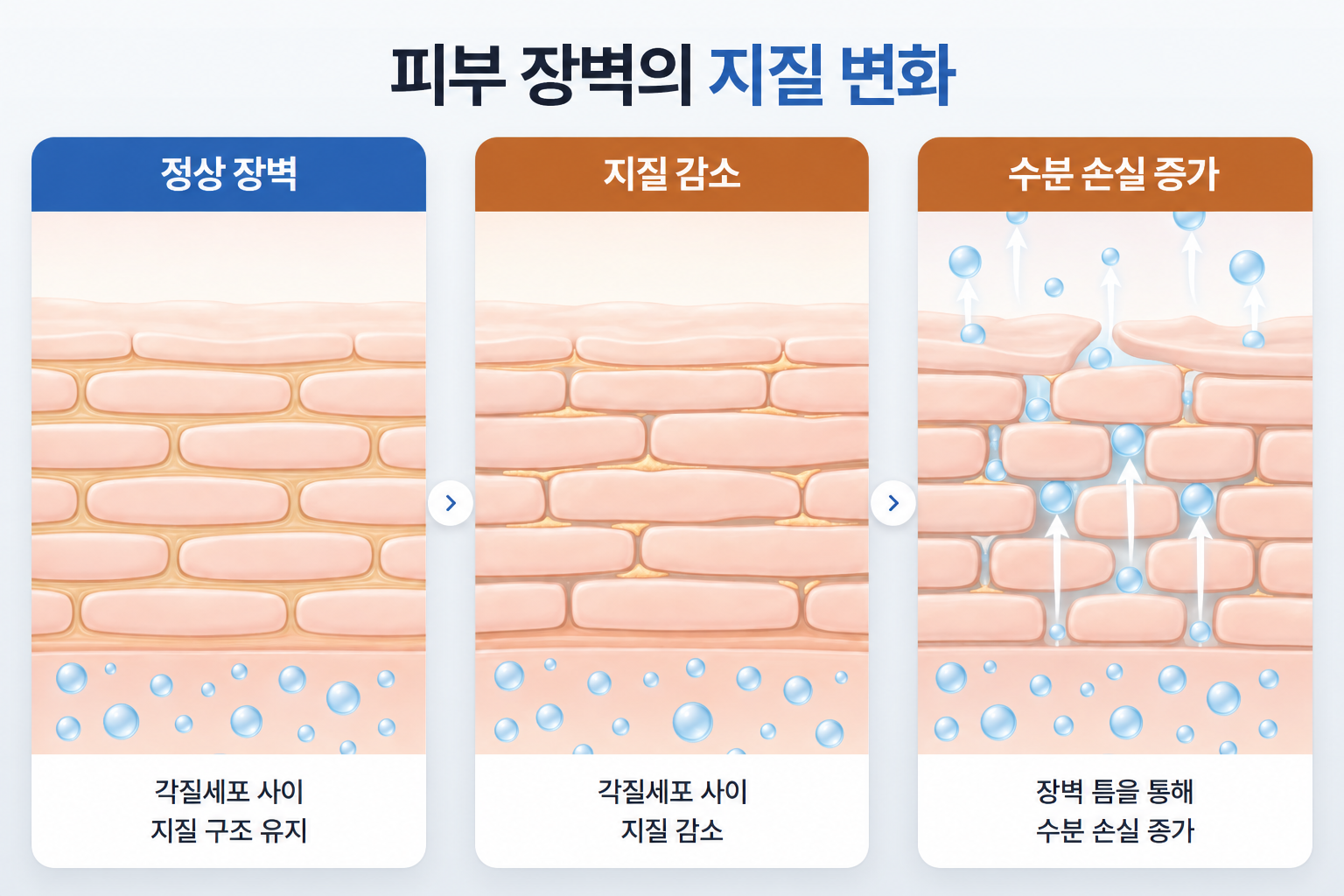 건조한 피부의 원인인 장벽 지질 감소와 각질세포 사이 틈으로 수분 손실이 증가하는 3단계 변화