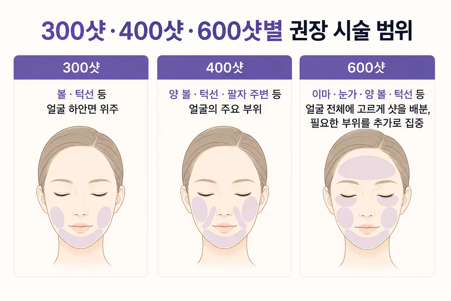 올리지오 리프팅 300샷·400샷·600샷별 권장 시술 범위