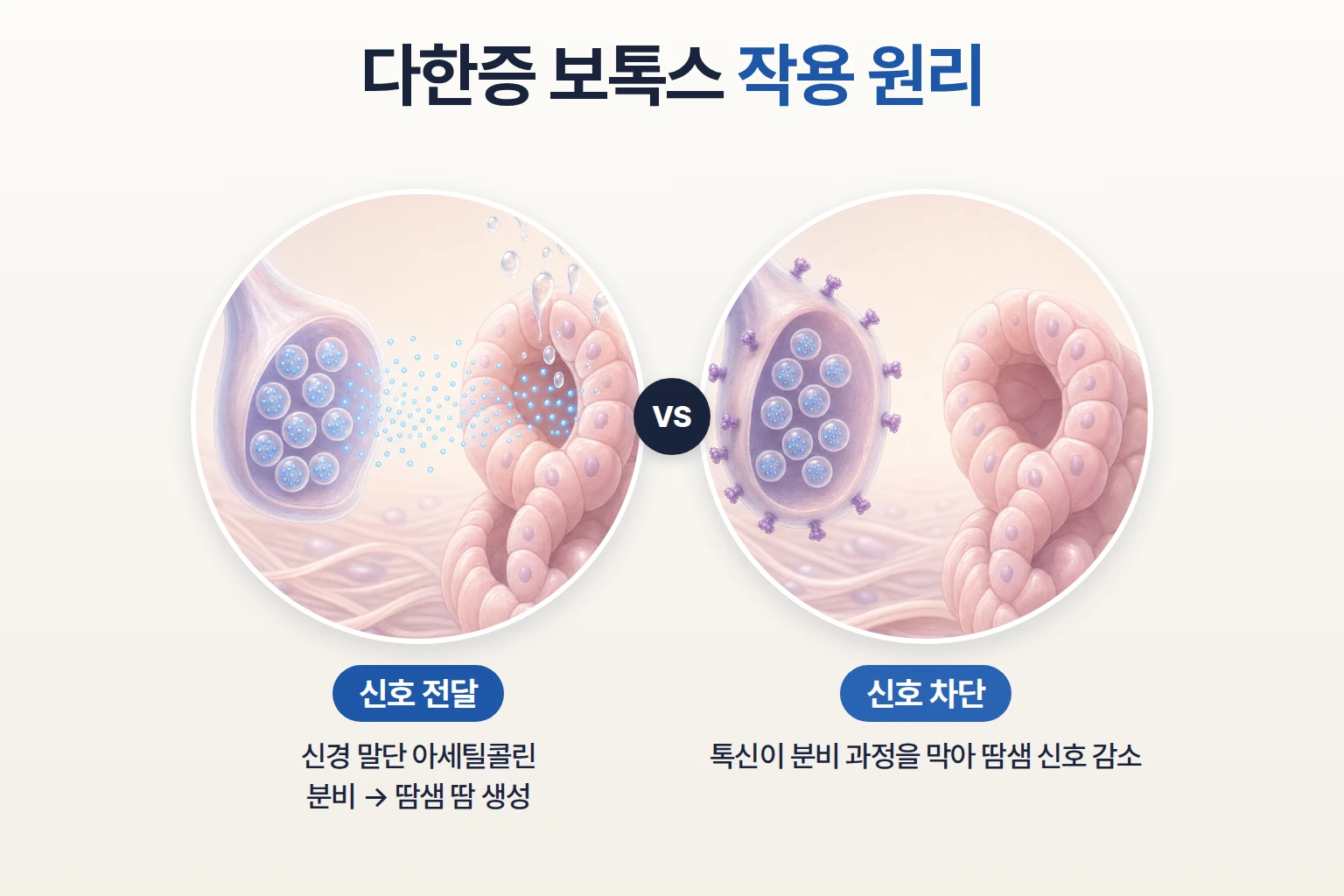 신경 말단의 아세틸콜린이 땀샘에 전달되는 모습과 톡신 작용 후 신호가 끊긴 모습을 비교한 모식도