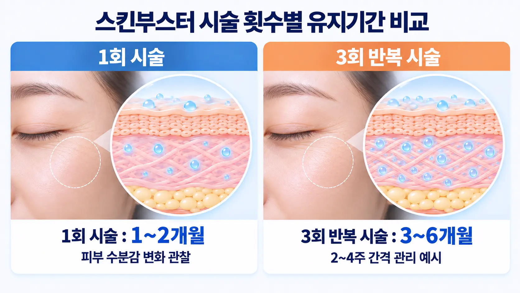 스킨부스터 1회와 3회 반복 시술의 효과 유지기간 및 피부 상태 비교