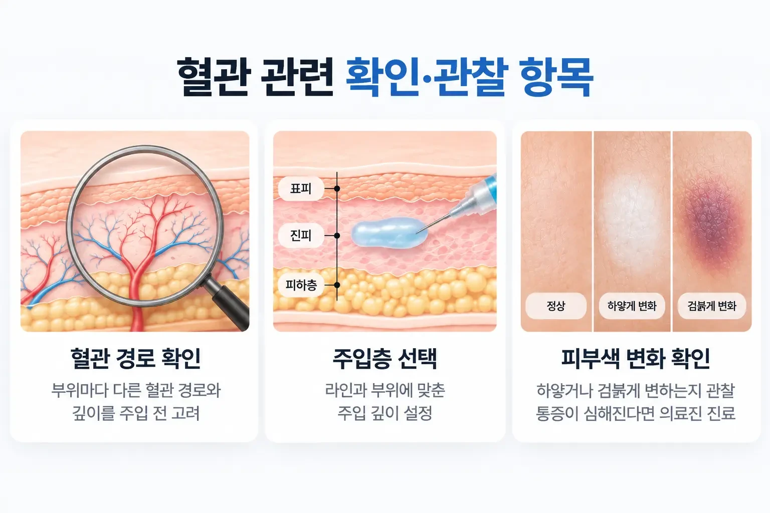 혈관 경로 확인, 주입 층위 선택, 피부색과 통증 변화 관찰을 정리한 필러 시술 확인 항목 이미지