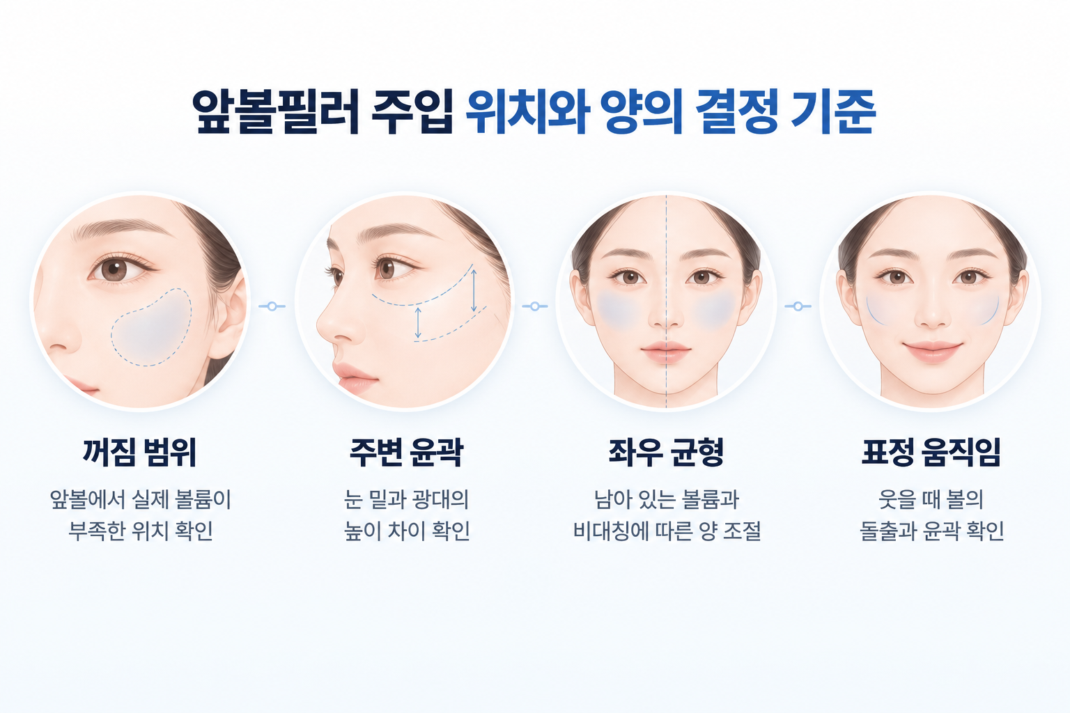 앞볼필러 주입 위치와 양을 결정할 때 확인하는 꺼짐 범위, 눈 밑과 광대의 높이 차이, 좌우 볼륨 균형과 표정 움직임