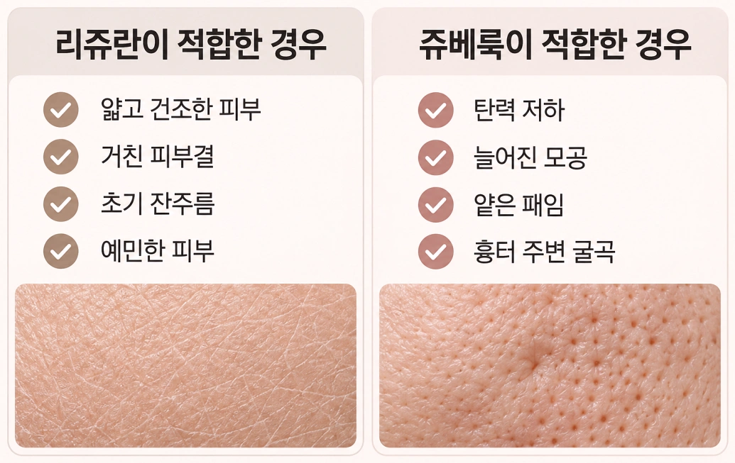 리쥬란과 쥬베룩의 피부 고민별 적합한 적용 대상을 비교한 인포그래픽