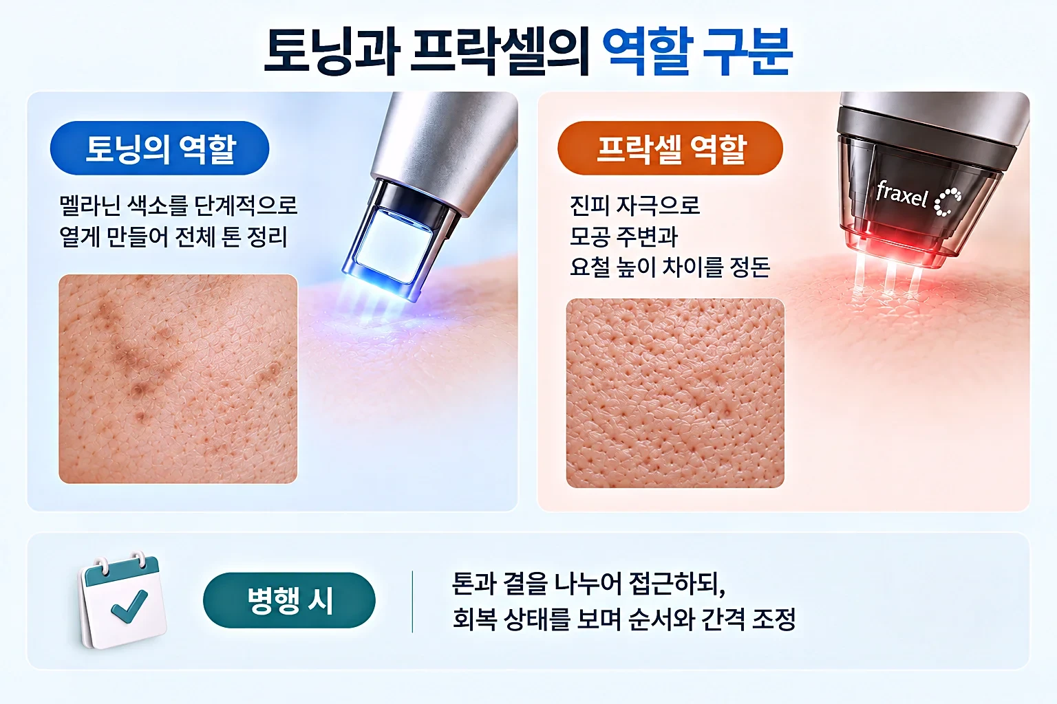토닝과 프락셀 계열의 역할을 색소 톤, 표면 요철, 병행 간격으로 구분한 관리 이미지