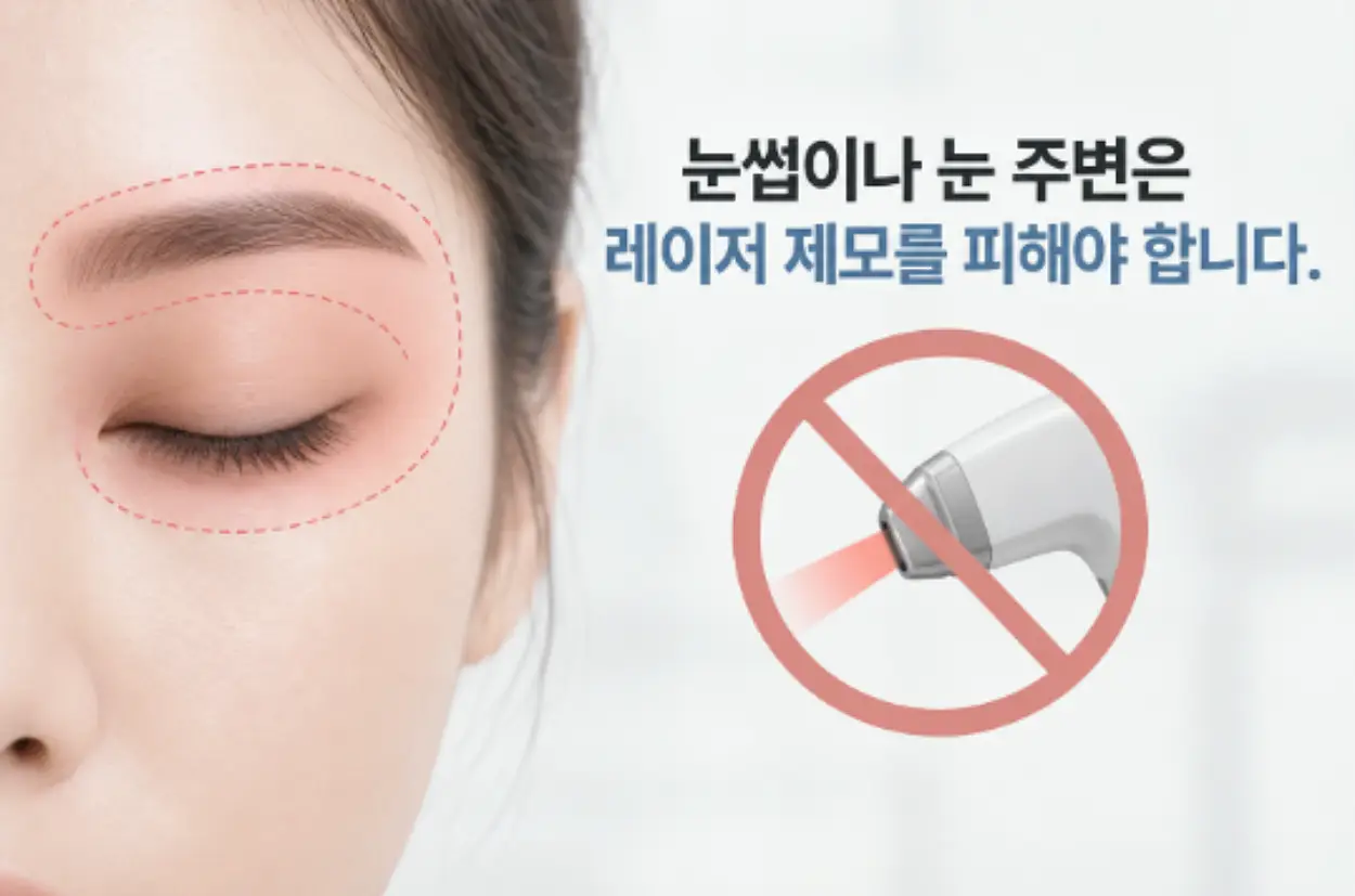 눈 주변 얼굴 레이저 제모 - 불가능한 이유