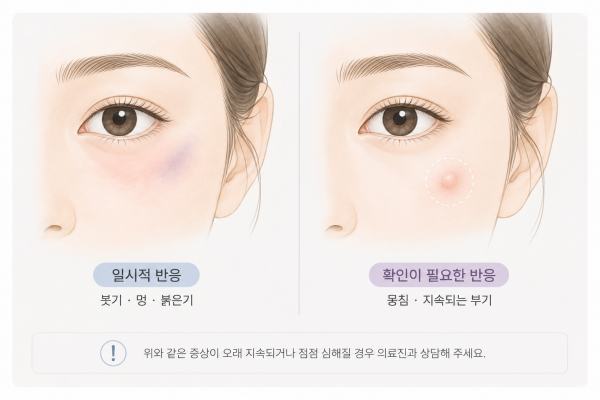 시술 후 붓기 멍 붉은기와 지속되는 뭉침 부기 반응 비교