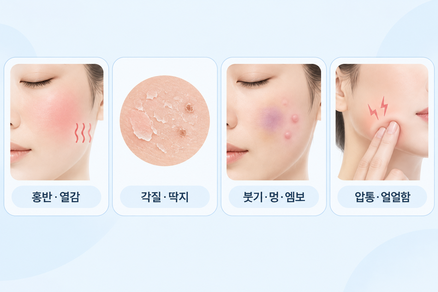 피부과 시술 후 나타날 수 있는 홍반·열감, 각질·딱지, 붓기·멍·엠보, 압통·얼얼함 정리
