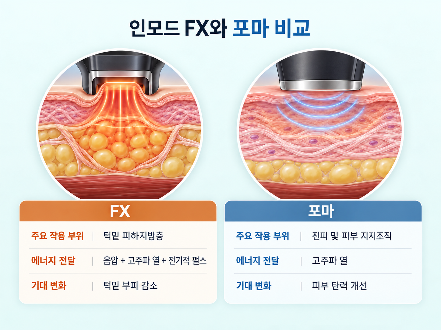 인모드 FX의 턱밑 피하지방층 음압·고주파 에너지 전달과 포마의 진피 콜라겐 열 자극을 통한 지방 부피 감소 및 피부 탄력 개선 비교