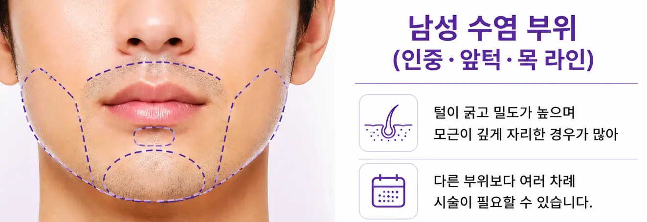 대구 레이저 제모 남성 수염 부위의 특징