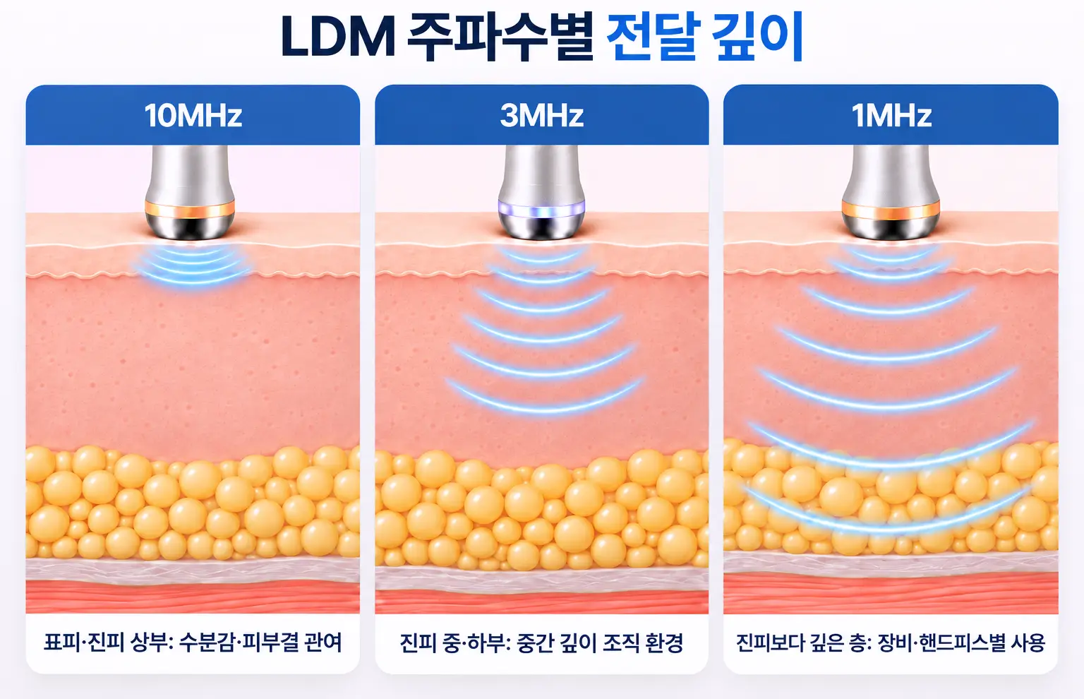 10MHz, 3MHz, 1MHz LDM 초음파가 피부 층별로 다른 깊이에 닿는 모습을 비교한 단면도