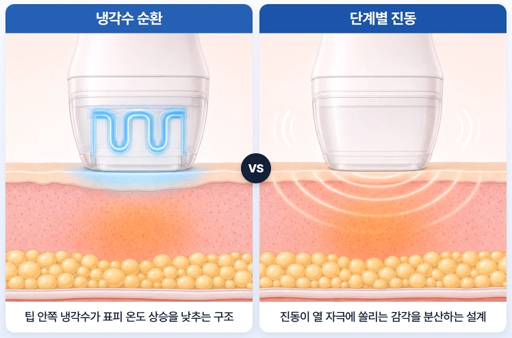 냉각수 순환과 단계별 진동 기능이 피부 표면의 열감과 시술 자극을 줄이는 원리를 비교한 볼뉴머 리프팅 모식도