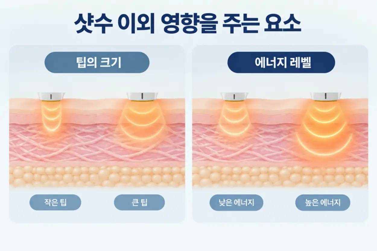 볼뉴머 전후 변화에 영향을 줄 수 있는 요소