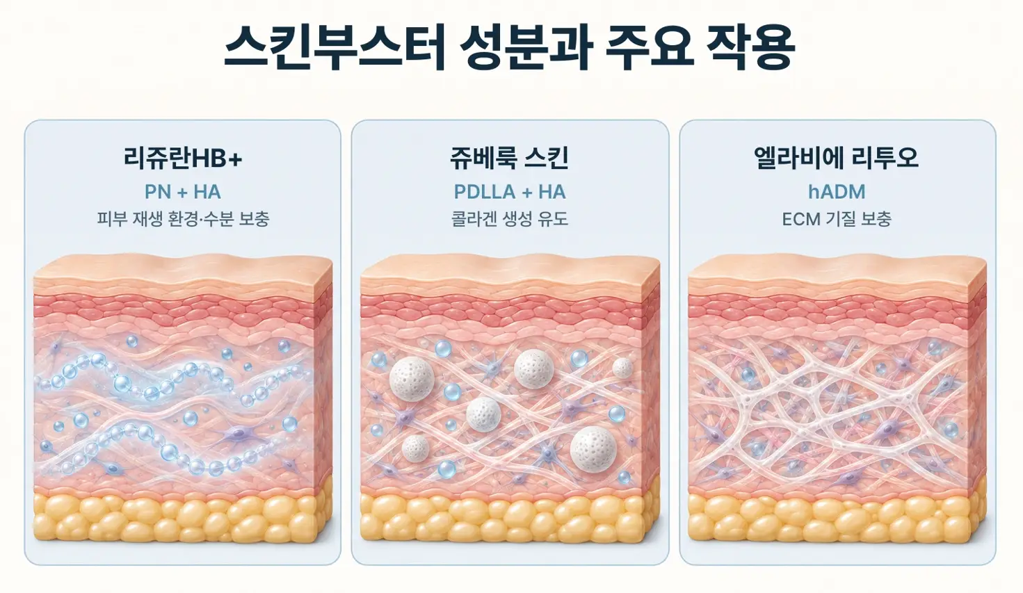 리쥬란HB+ PN과 HA 쥬베룩 스킨 PDLLA와 HA 리투오 hADM 성분 및 피부 작용 비교