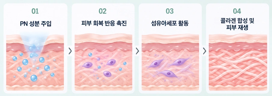 리쥬란 PN 성분 주입 후 피부 회복 반응과 섬유아세포 활성화, 콜라겐 형성 과정을 나타낸 피부 단면도