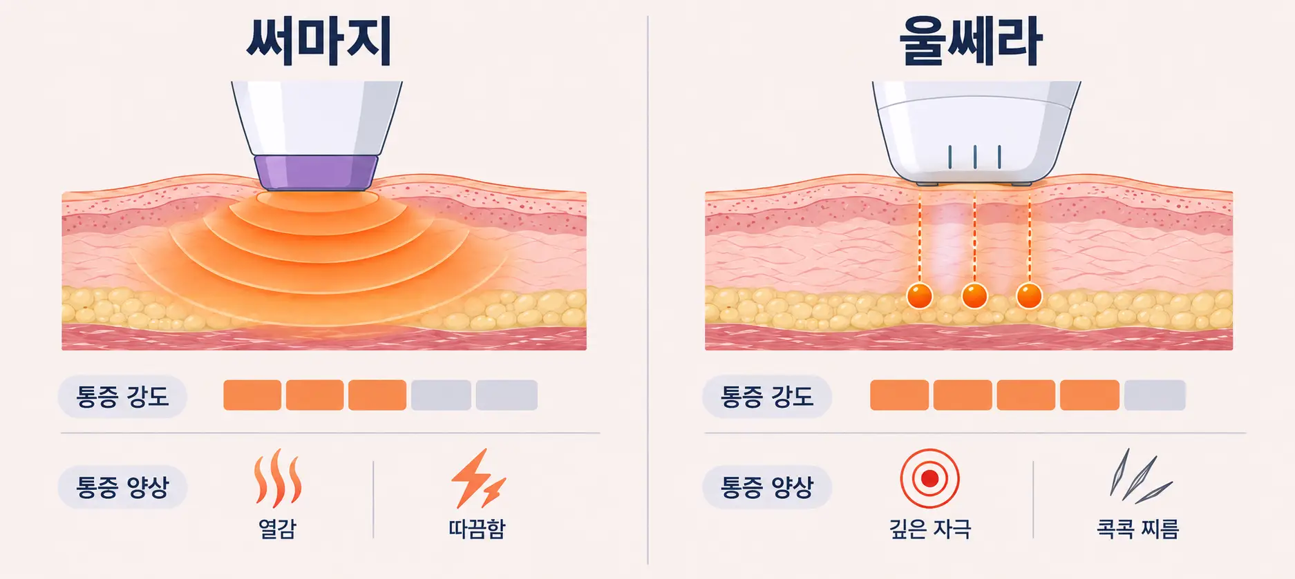 써마지의 열감과 울쎄라의 찌릿한 통증 양상 차이 비교