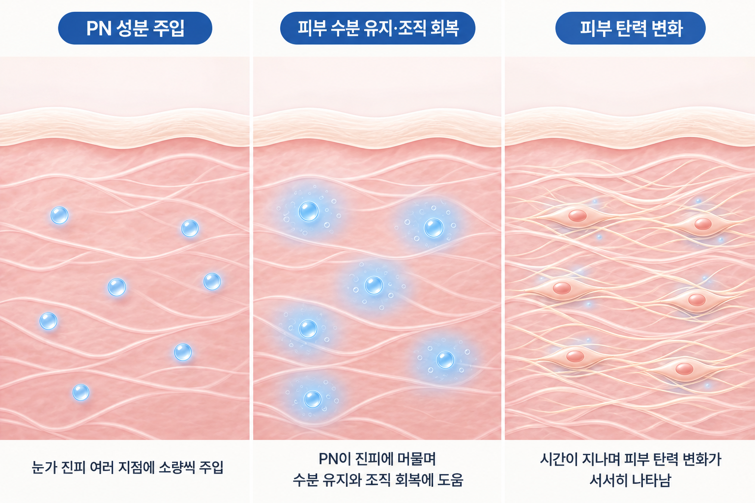 리쥬란 아이 PN 성분의 눈가 진피 주입과 수분 유지, 조직 회복 및 피부 탄력 변화 과정