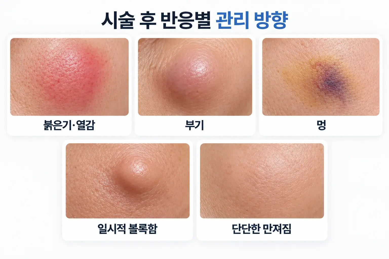 고우리 부스터 시술 후 붉은기, 부기, 멍, 볼록함에 따른 관리 방향을 정리한 관리 이미지