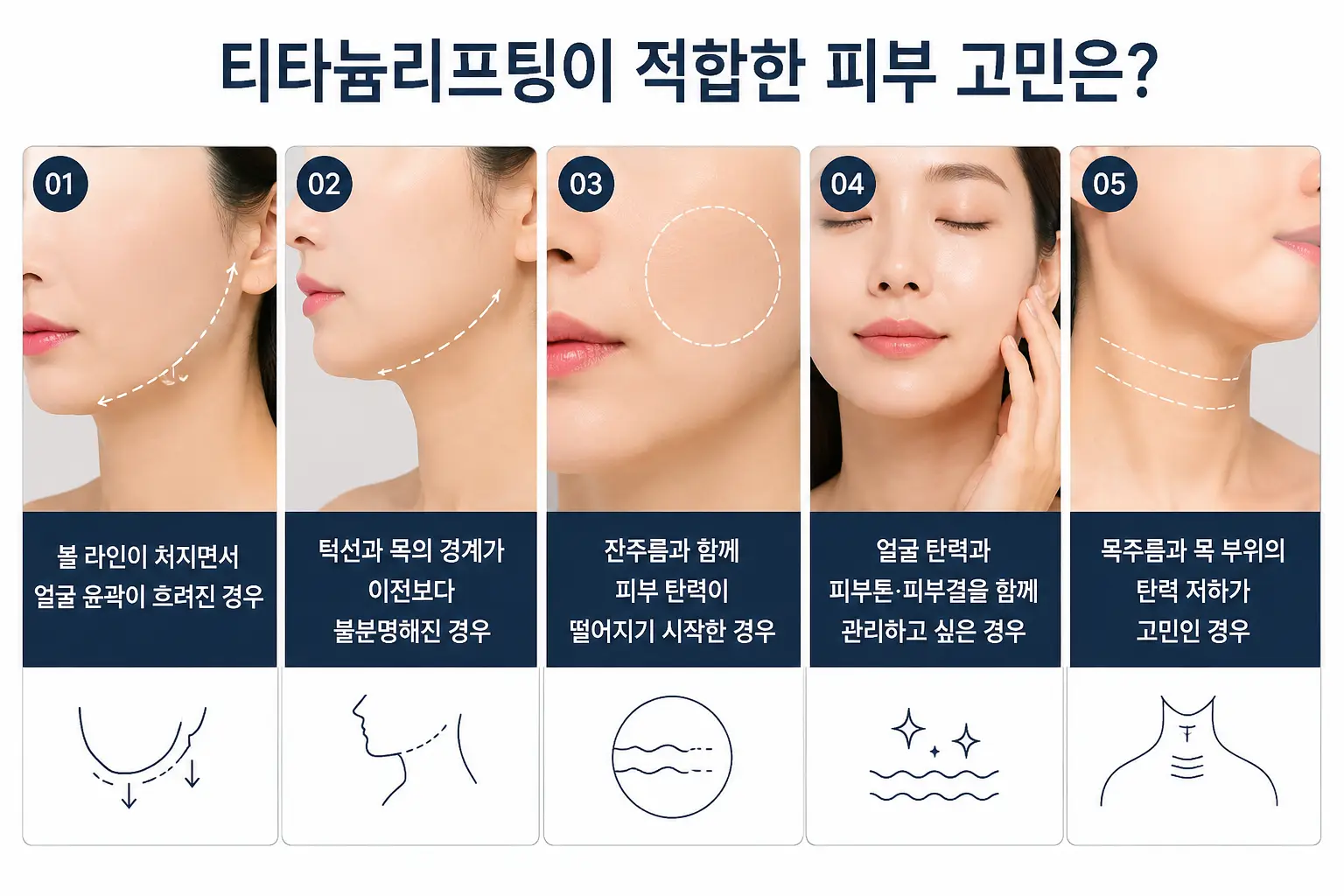 피부 고민에 따라 살펴보는 티타늄리프팅 효과와 적합한 유형