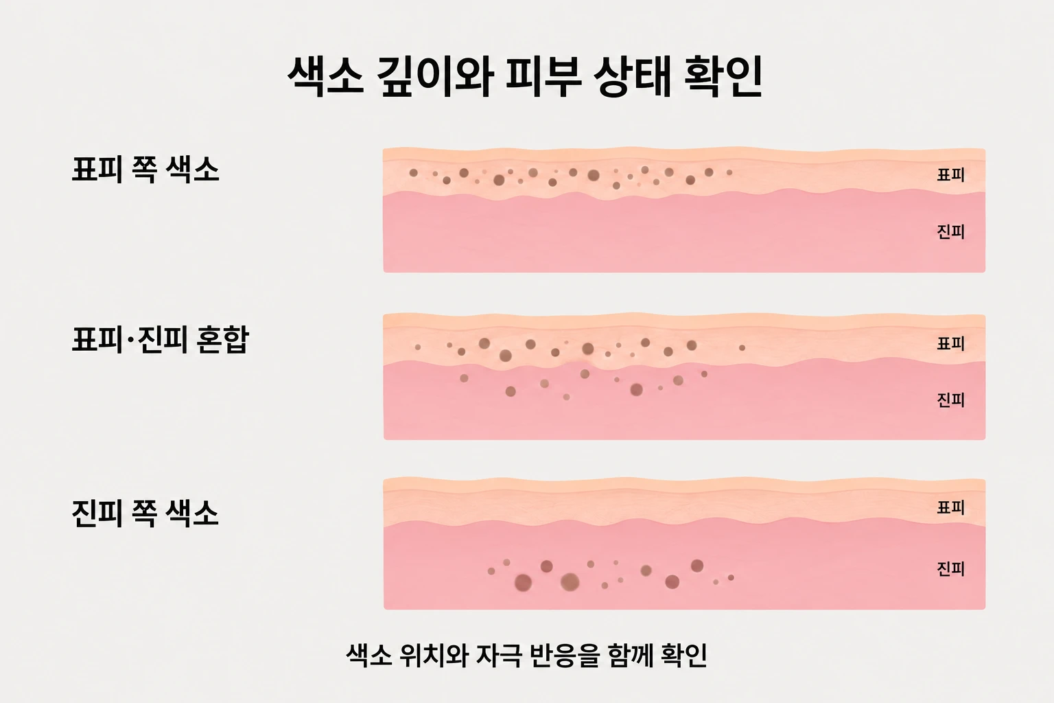 표피와 진피에 분포하는 색소의 깊이를 비교한 피부 단면