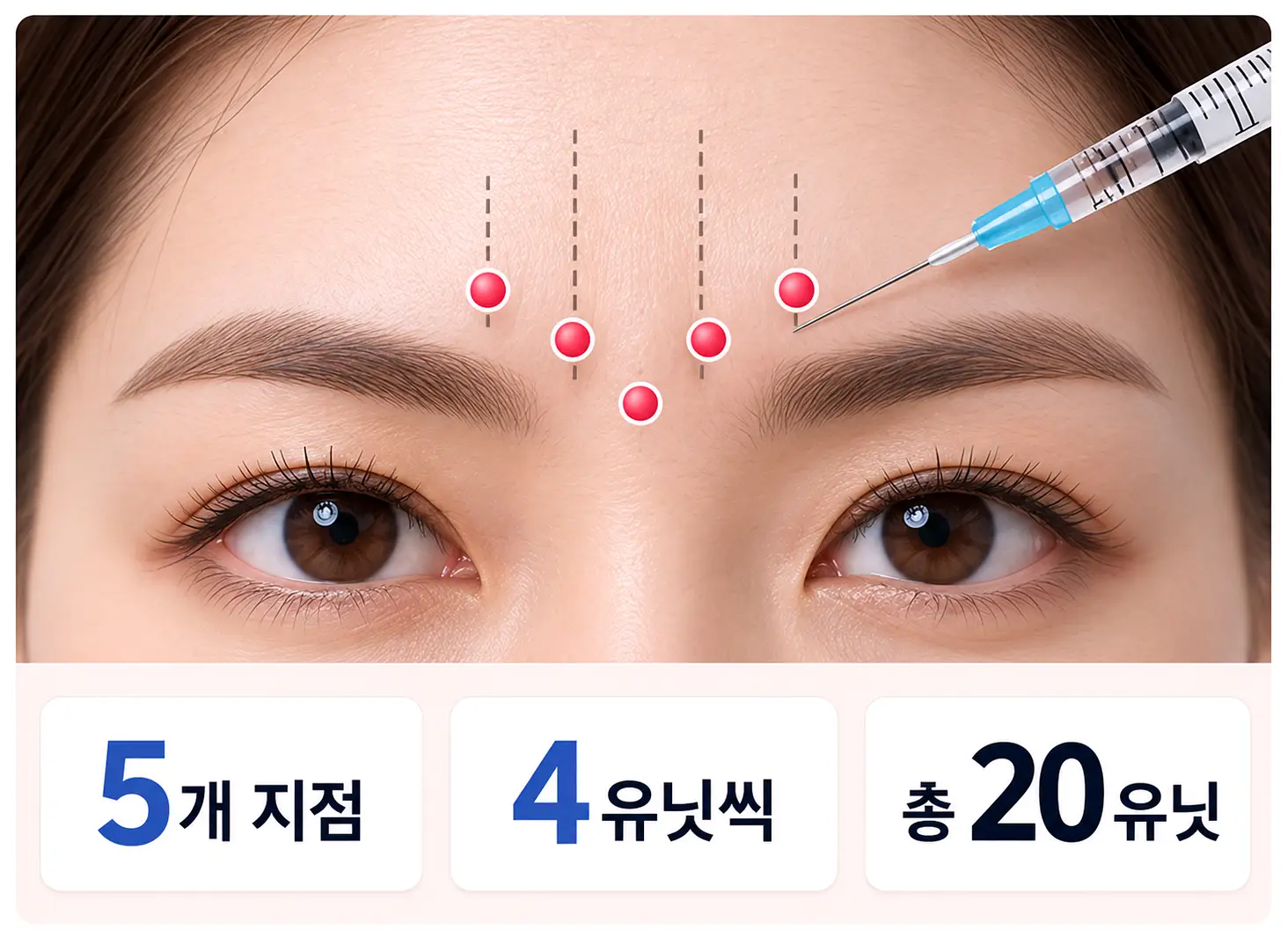 미간주름 보톡스 시 미간 근육을 고려한 주사 위치와 용량 설정