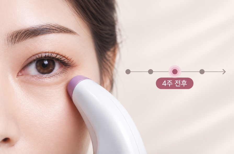 아이써마지 효과가 나타나는 시기 정리 - 4~6주 전후
