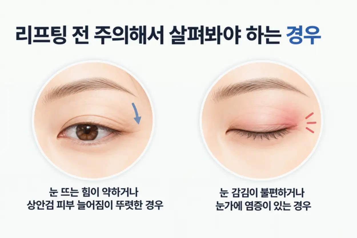 눈꼬리 리프팅 전 살펴봐야 하는 경우