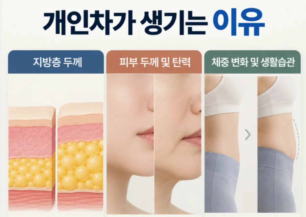 인모드 1회 효과 개인차 생기는 이유